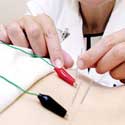 Combining Acupuncture and Electricity Combining Acupuncture and Electricity