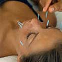 How The Needles Are Used By The Acupuncturist How The Needles Are Used By The Acupuncturist
