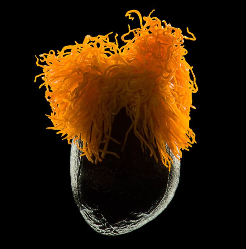 Bird of paradise seed (10X magnification) taken at Institute of Pathophysiology, First Medical Faculty, Charles University in Prague, Czech Republic