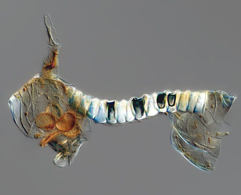 Fern Spore (20X magnification) taken at The Wistar Institute in Philadelphia, Pennsylvania