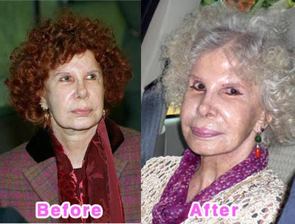 The Before and After Before and After... does it work?