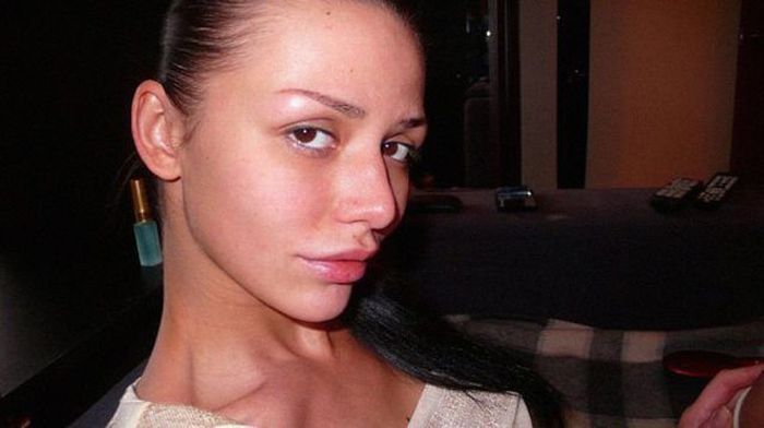 operacije Beauty or?