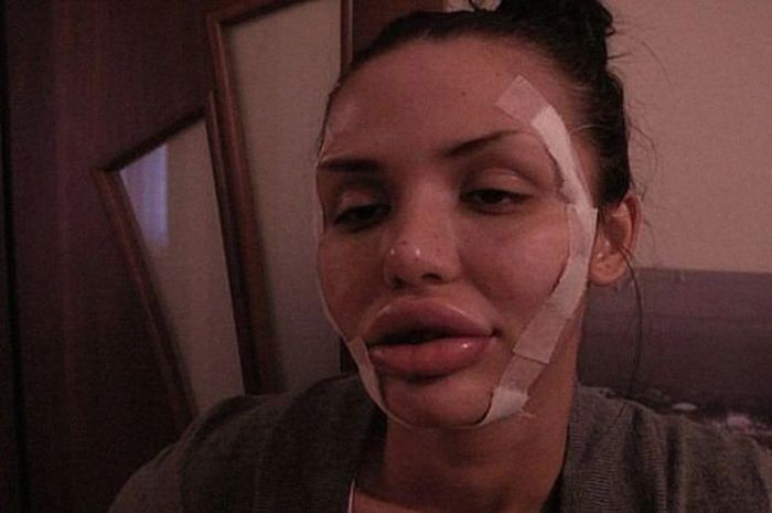 operacije Beauty or?