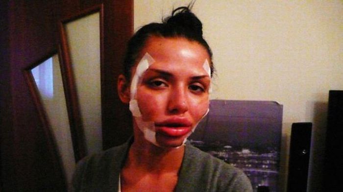 operacije Beauty or?