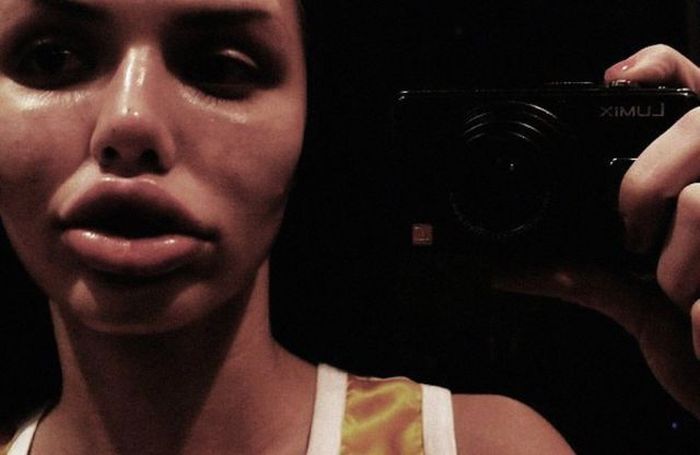 operacije Beauty or?