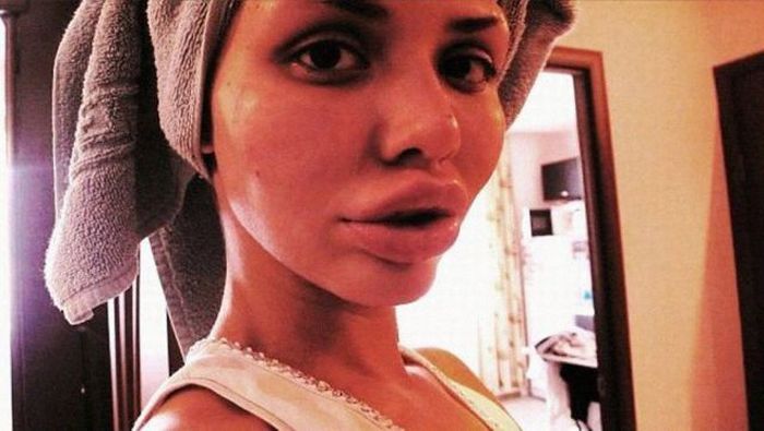 operacije Beauty or?