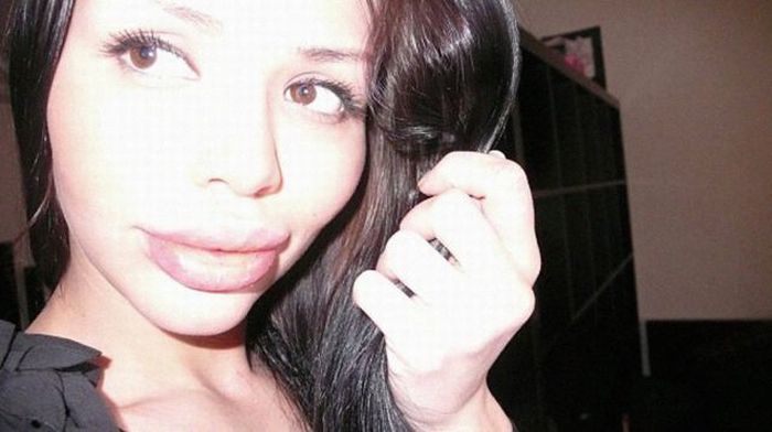 operacije Beauty or?